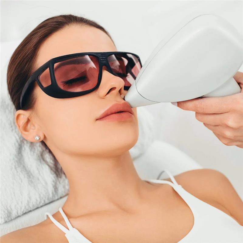 laser-hair-removal-treatment-in-indore